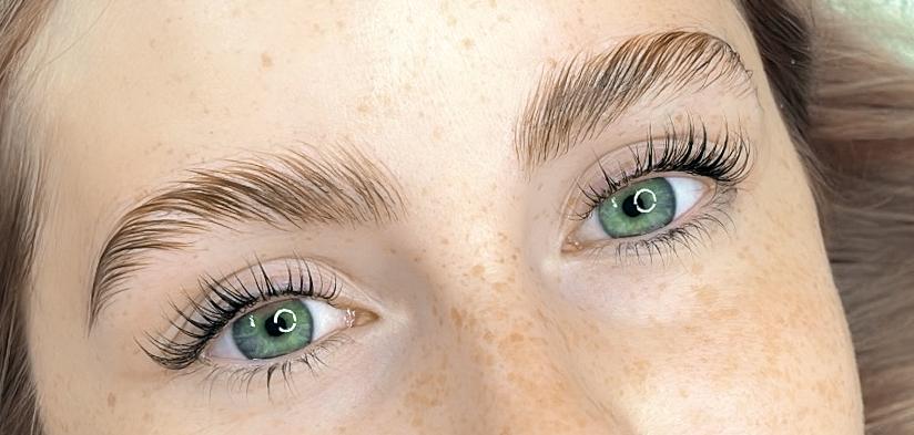 Brow Lifting in Neuenhof - Bild 1