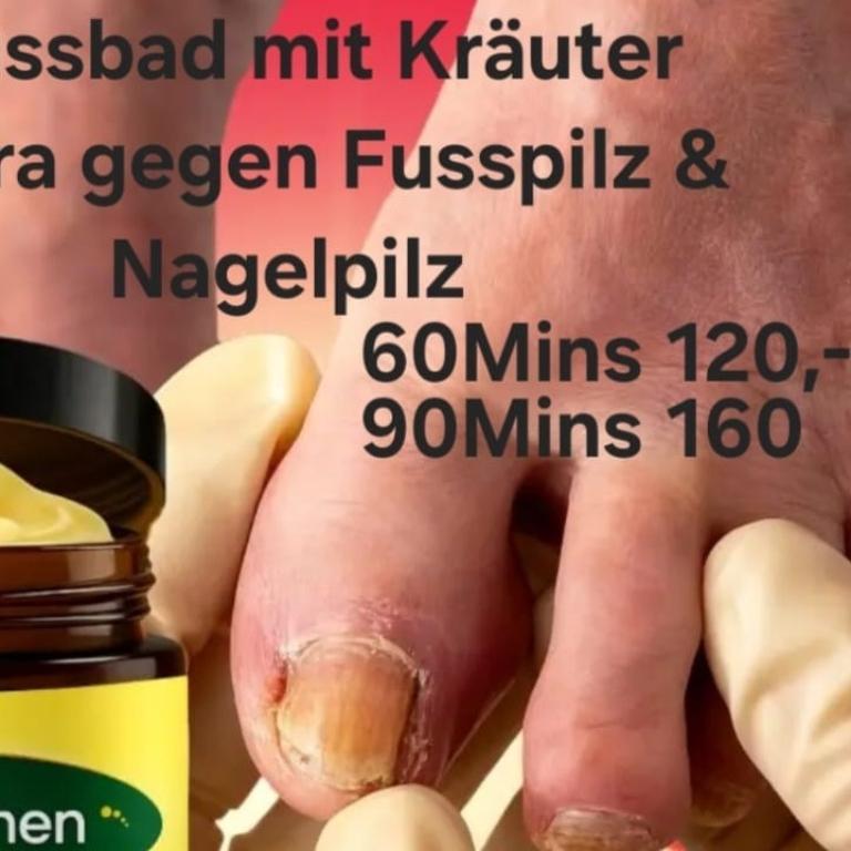 Fusspilze, Hühneraugen, Warzen, Nagelpilz Fusspflege in Emmen - Bild 1