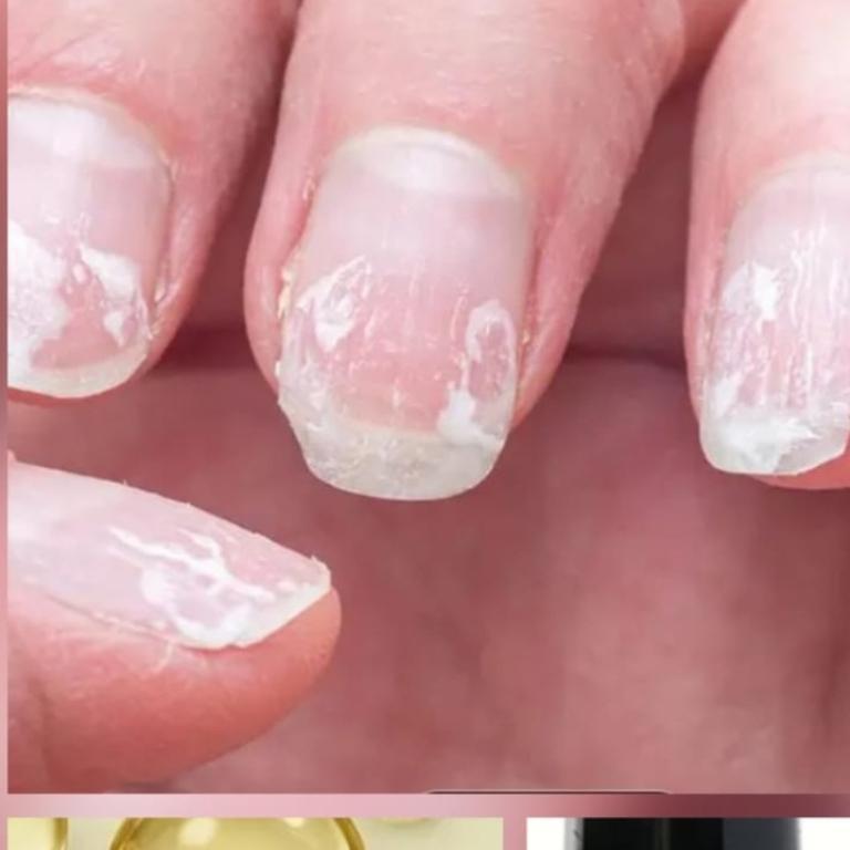Fusspilze, Hühneraugen, Warzen, Nagelpilz Fusspflege in Emmen - Bild 6