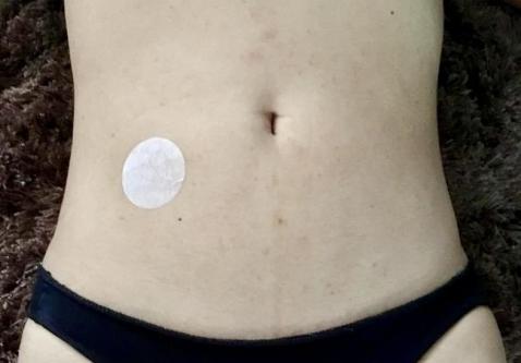 Alkapatch cholesterol and triglycerides63835270737795121