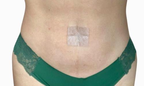 Panao antidiabetic patch 12 patches63835270787587121